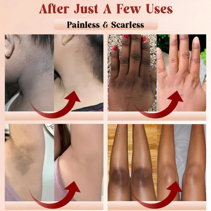 Luxorai™  Orange Enzyme Exfoliating Gel