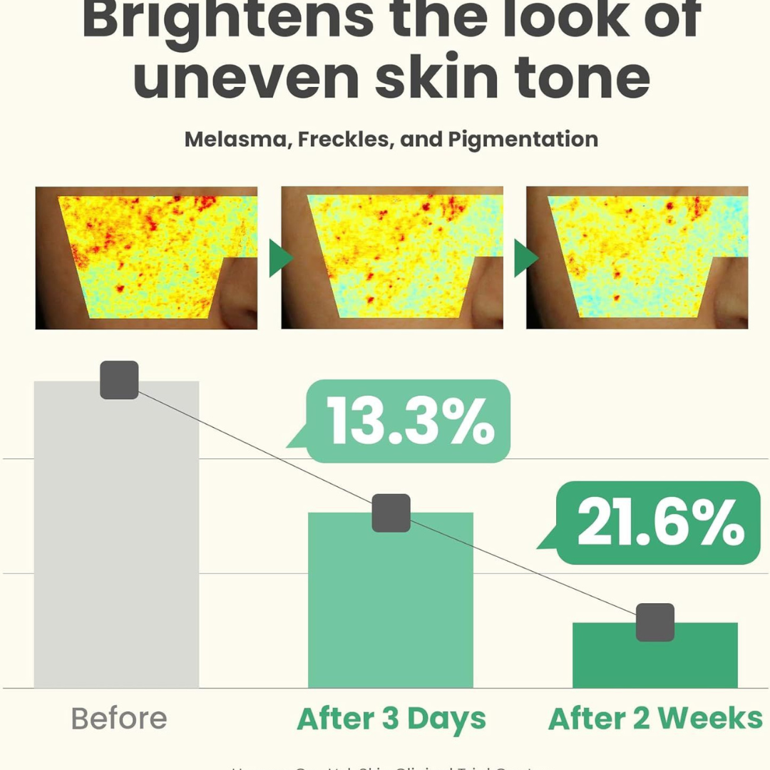 Dark Spot Correcting Glow Serum 50ml.