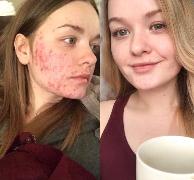 Dark Spot Correcting Glow Serum 50ml.